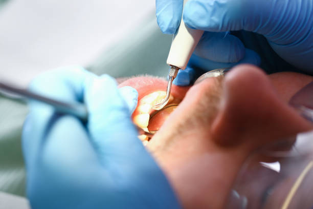 Best Emergency Dentist for Knocked-Out Tooth in Atlantic Beach, NY